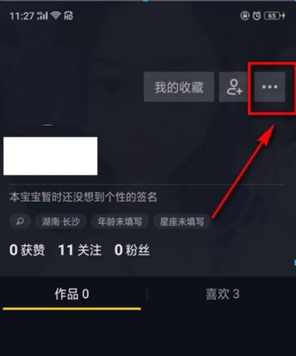 抖币价格是多少? 抖音币充值方法攻略介绍!