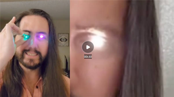 美国一男子将义眼改装成手电筒：发光钛合金眼成真！炫酷