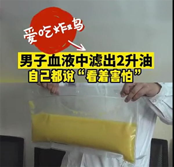 274斤男子血管抽出2升“油”！血管怎么变成了“油管”？