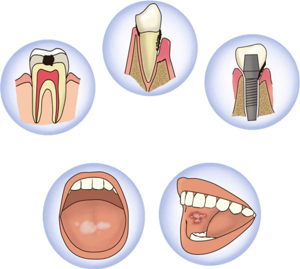 早起先吃饭还是先刷牙？这里面有大学问