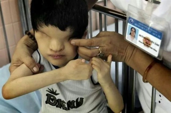 美国人扔下的橙剂遗毒有多可怕！坑害了300万越南人