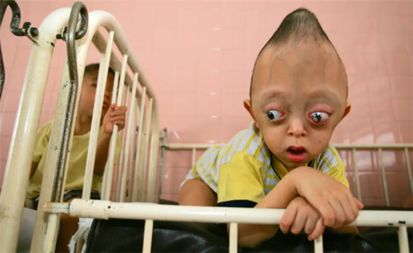 美国人扔下的橙剂遗毒有多可怕！坑害了300万越南人