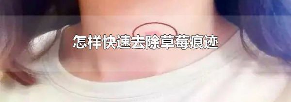 怎样快速去除草莓痕迹