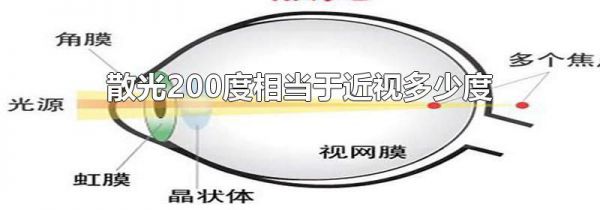 散光200度相当于近视多少度