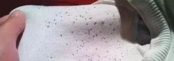 衣服上出现了很多小黑点,怎么办?