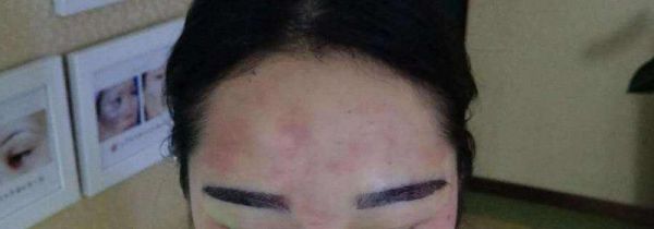 补眉毛几天掉痂