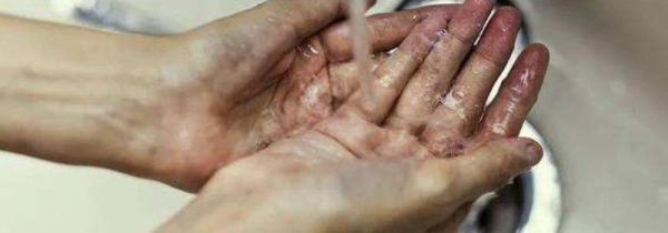 正确戴口罩的六个步骤