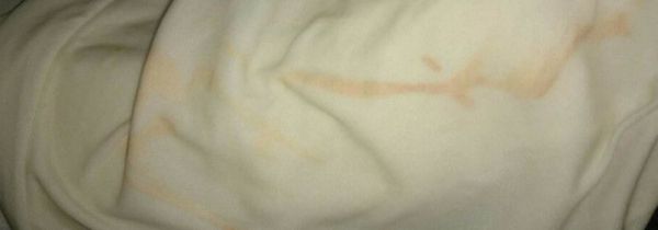 84消毒液把白色衣服漂黄了怎么办