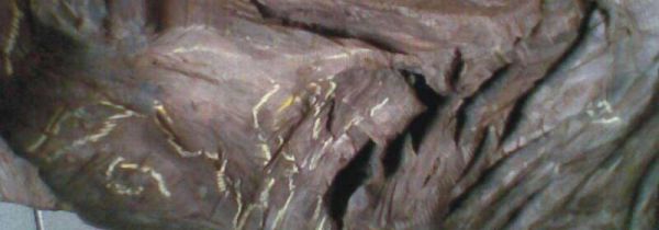 樟木水泡脚禁忌