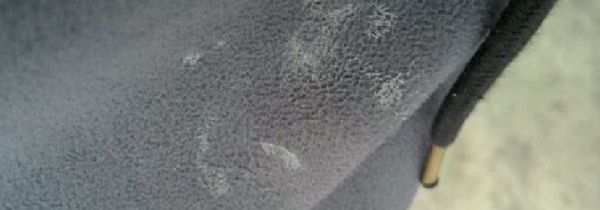 衣服上沾了胶怎么清除