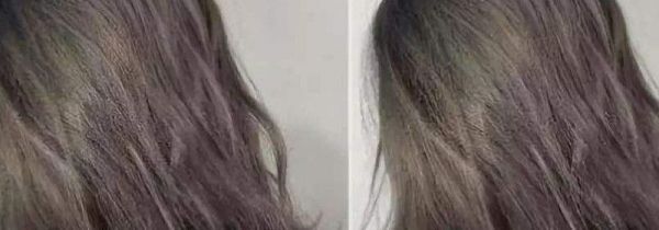 漂发后多久可以洗头