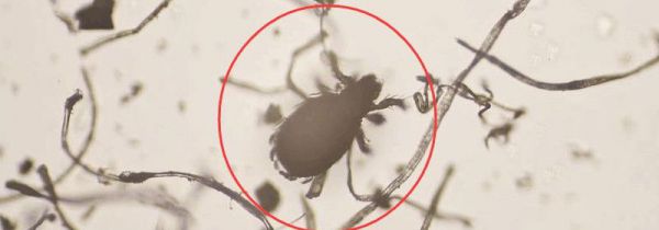 香叶可以去螨虫吗