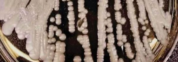 消毒液能杀死真菌吗