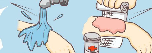 12个急救小技巧