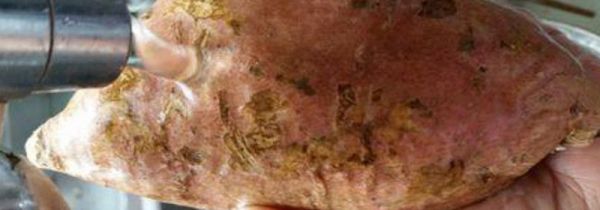 吃了坏红薯怎么解毒