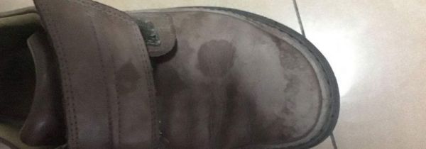 鞋子弄到油怎么洗掉