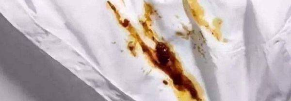 白衬衫火锅油渍怎么洗