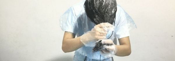 硫磺皂洗头好吗