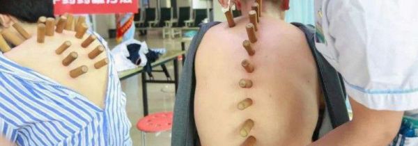 拔罐拔出水泡是怎么回事