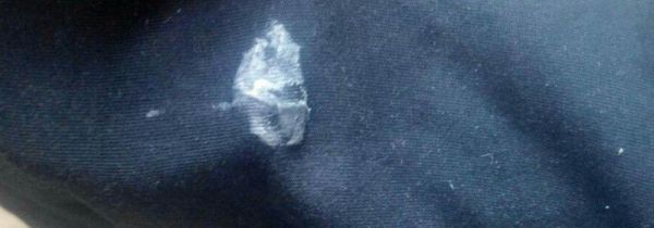 衣服上有口香糖怎么去除小窍门